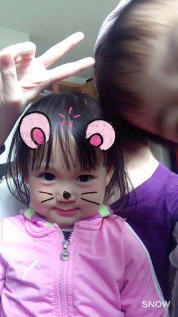 2岁半孩子脚趾底部脱皮,两三个星期了不见好!