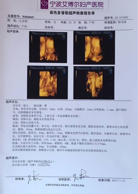 到底多少周?_按末次月经算现在怀孕应该是25