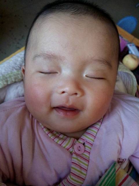 惜缘_百日孩子眉毛间长红点点怎么办