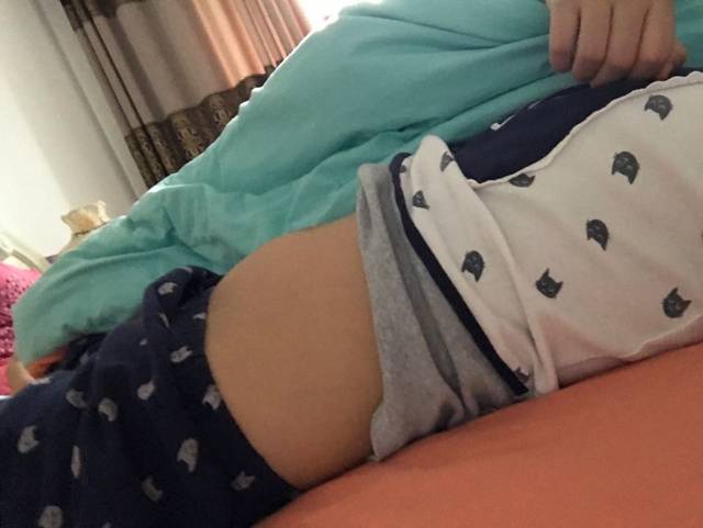 孕四个月,躺下侧面拍照肚子如图大小~正常嘛?