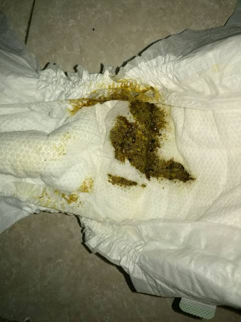 宝宝大便正常吗_大家好,我家宝宝出生一周了,