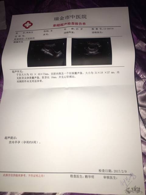 看孕囊判断胎儿性别_孕7周3,第一次做B超,胎心