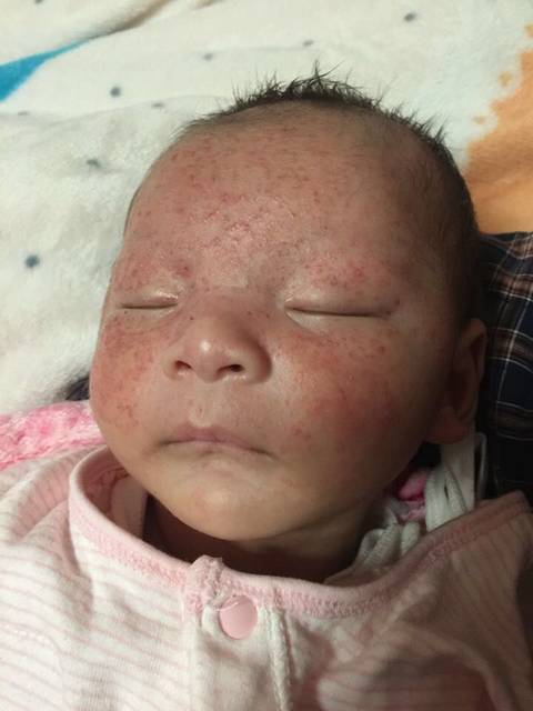 戒之馆的婴亲霜有用过的吗?求分享!_宝宝之前