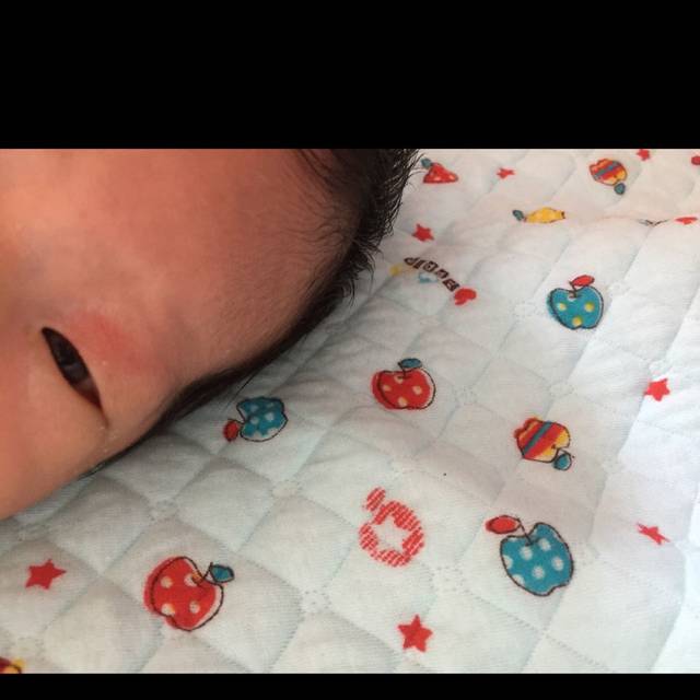 新出生宝宝脸上有块红色血丝斑 时装那么回事