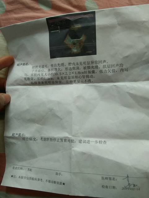 怀孕两月有胎芽没有胎心_停经六十天去医院做