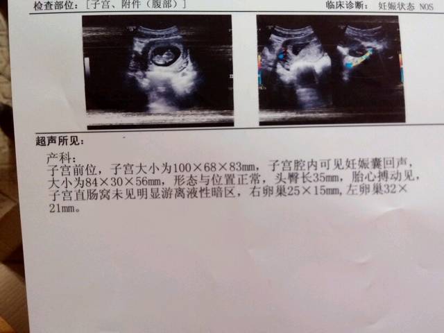 孕两个月,求大神看B超单,告知是男是女!_求大