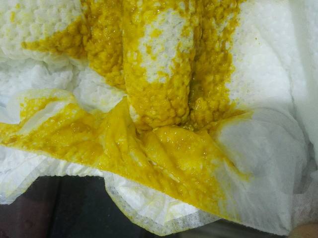 麻烦大伙帮我看看还没满月的宝宝是不是拉稀了