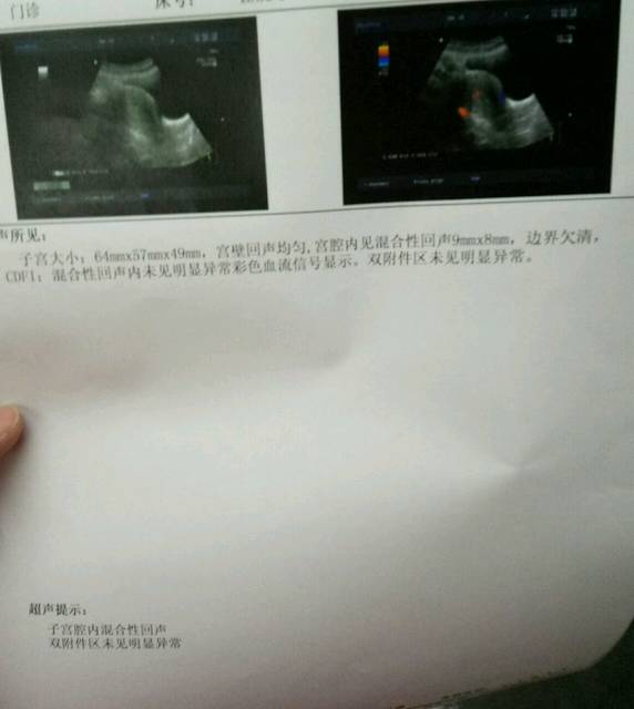 药流过的宝妈进来一下_我已经药流半个月了还