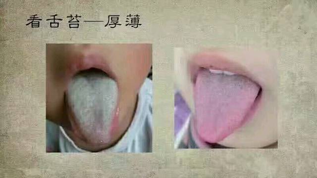 怎么看舌苔防疾病?_下面给大家简单介绍几种