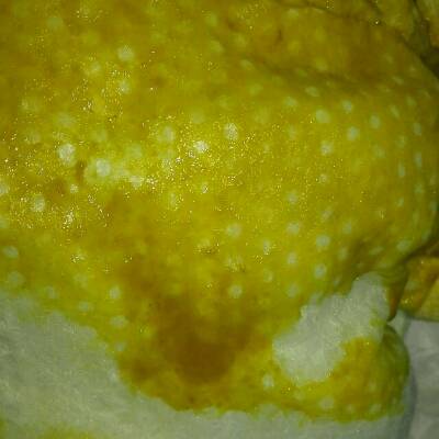 宝宝快满月的时候我耳朵发炎治疗停了10母乳