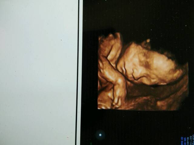 两次怀孕感觉和反应不一样,性别一样吗_同上,