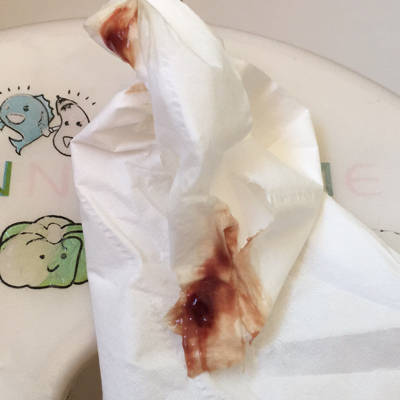 孕5w5d 有胎心胎芽 最近白带带血 粉色渐渐变