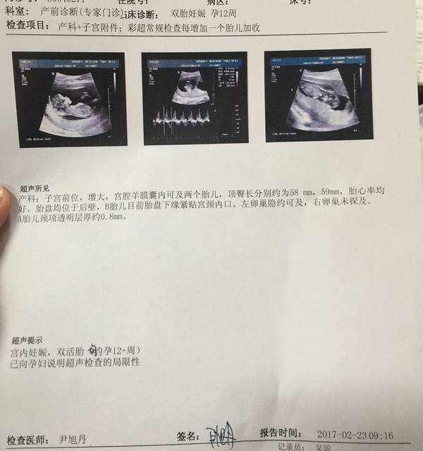 高龄孕妈双胎无创低风险顺利通过啦!_高龄、双