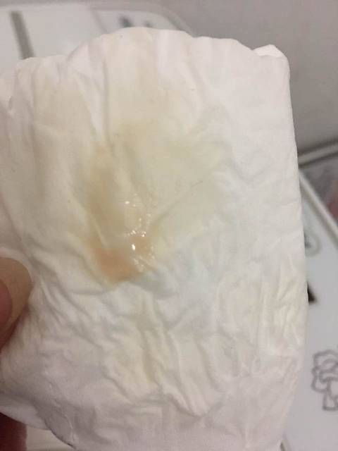 大神们帮忙看看_怀孕6周6天今天上厕所偶见褐