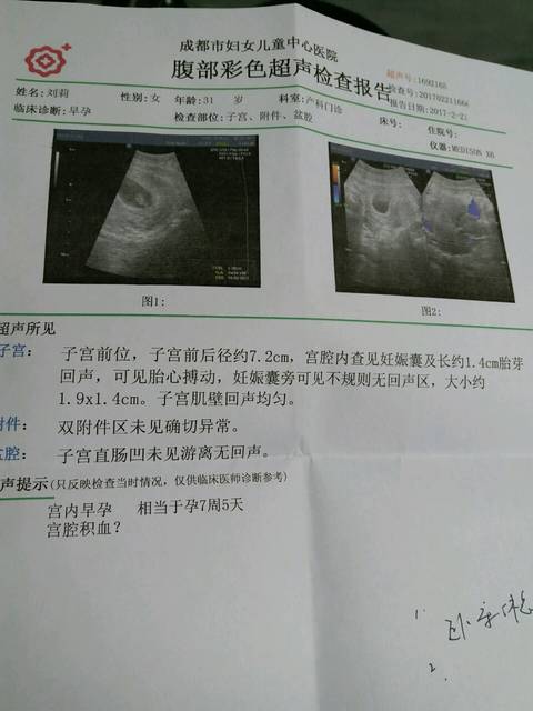 怀孕后第一次b超宫腔积血_因为是二胎,怀孕60