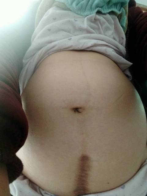 猜男女_后壁,胎心率140左右。七个多月