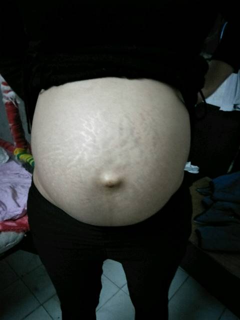 肚子也不小啊,纠结补还是不补_34周,bc上显示