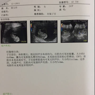 怀孕11周多了,今天去私立医院做NT检查,没有胎