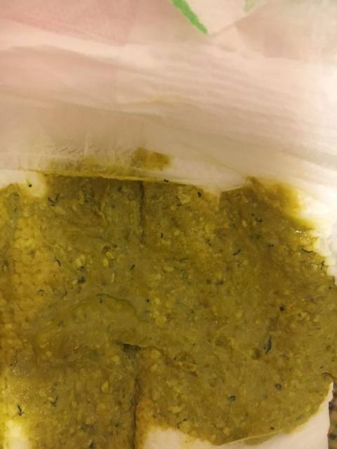 宝宝便便问题_宝宝最近的便便都是绿色带一点