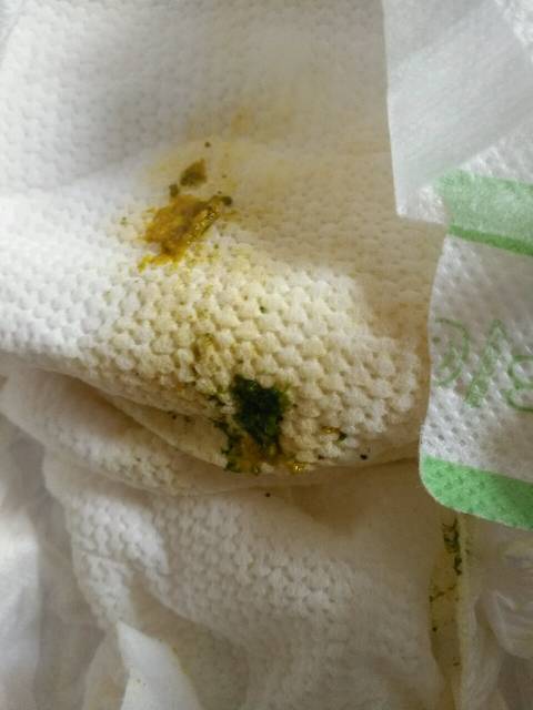 有经验的宝妈帮看看吧,很担心_宝妈们,帮看下