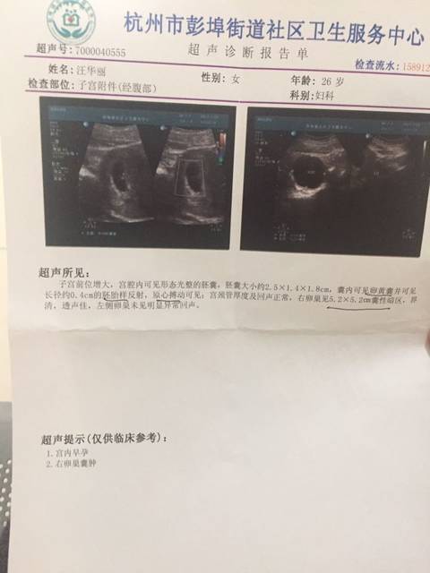 卵巢囊肿_现在7周了,6周的时候去医院做B超验