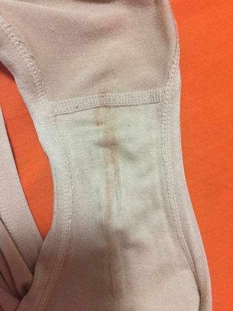 有同样症状的宝妈吗?_怀孕三十八天有褐色分