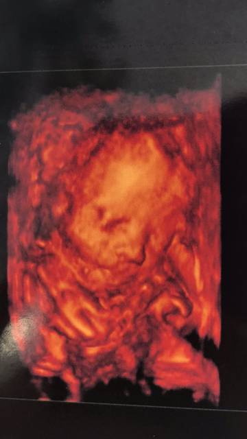 四维彩超不会翻盘的吧?