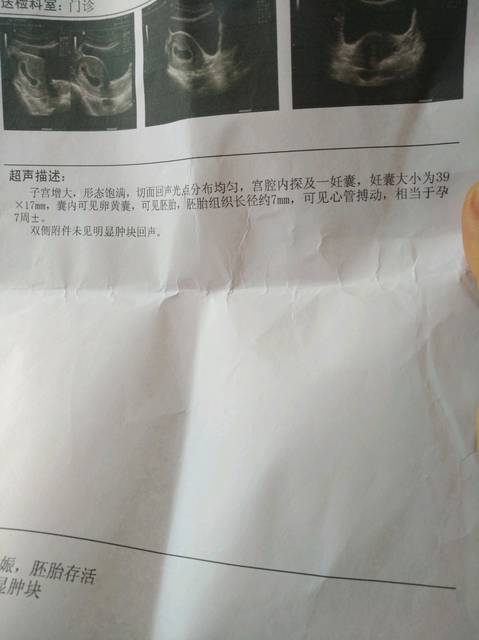 b超男孩女孩早知道。_现在偷偷地告诉你:B超