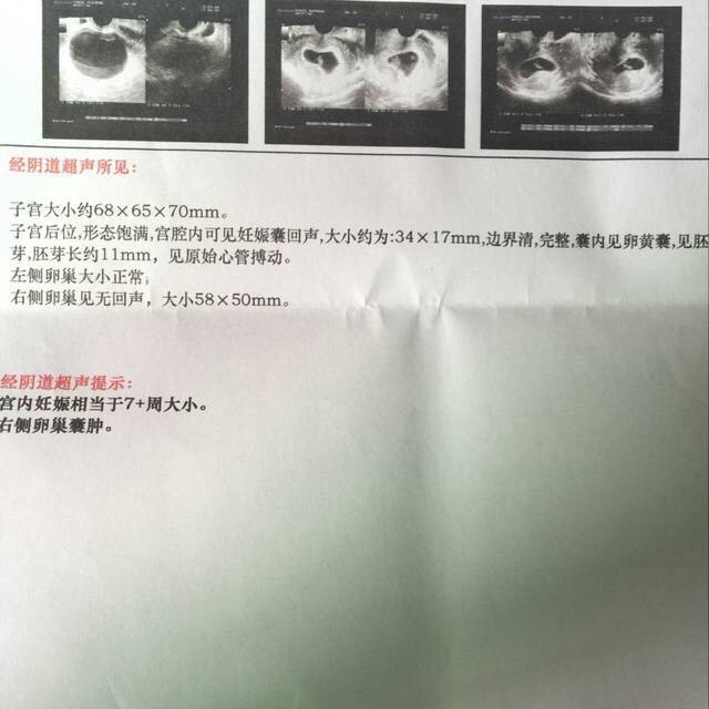 b超男孩女孩早知道。