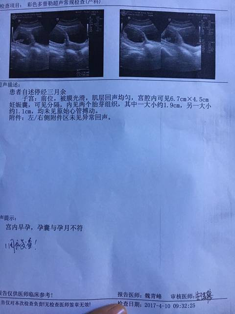 双胞胎、有没有懂的?_怀孕三个月,今天去医院