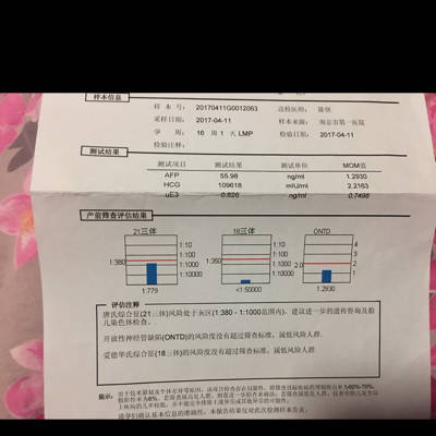 16周唐筛21三体低危,要紧吗?