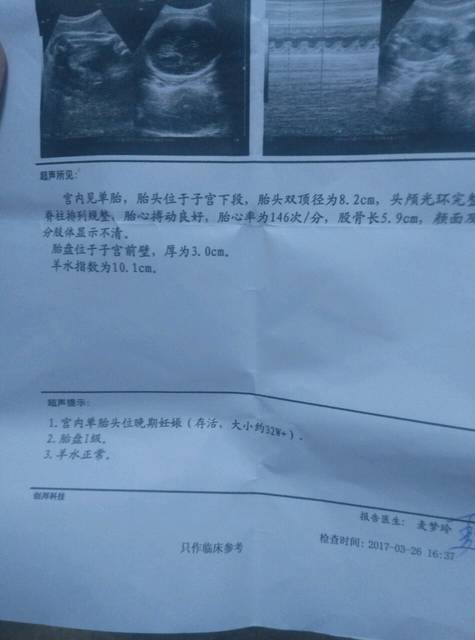 双顶径和股骨长判断男女