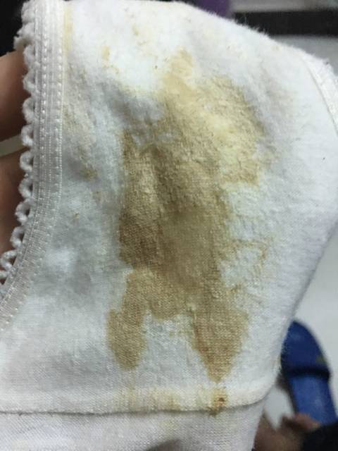 我现在怀孕6周,流褐色的分泌物有关系吗?刚开