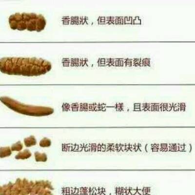 宝宝从出生到现在拉的便便都是糊状的正常吗?_全部回复_宝宝树