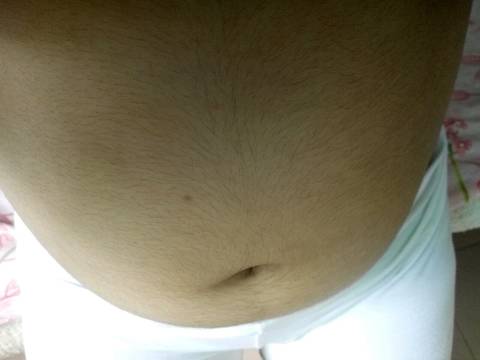 怀孕15周 肚子上长了好多黑色的毛毛,和老公的