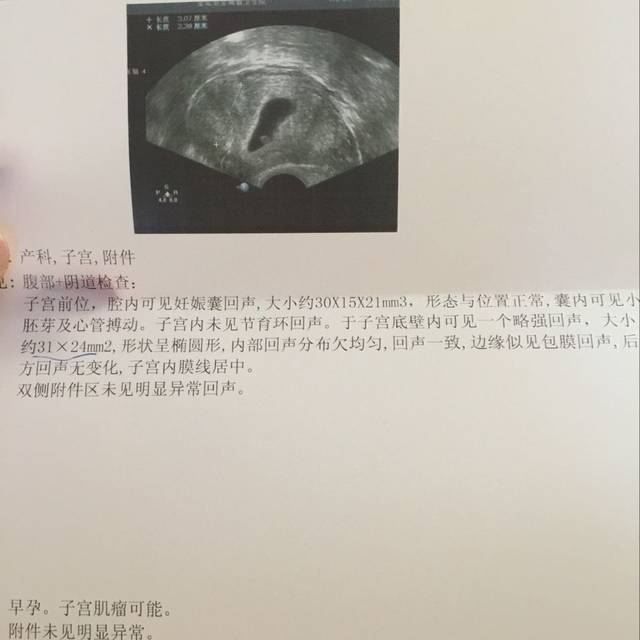 胎心胎芽都有,但是还是害怕胎停_末次月经3月