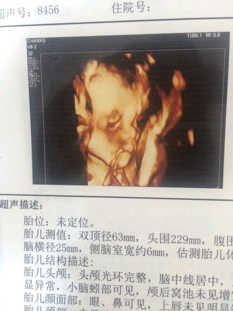 我的小可爱!_孕24周+ 糖筛正常 问了医生是个