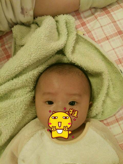 大小眼_宝宝出生时脐绕颈窒息,在医院住了5天