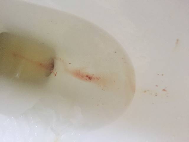 有着床出血的宝宝么一起讨论