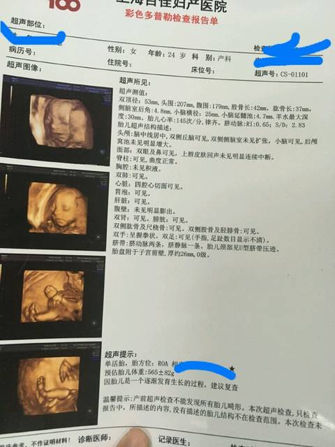 青浦大畸形筛查哪里做?