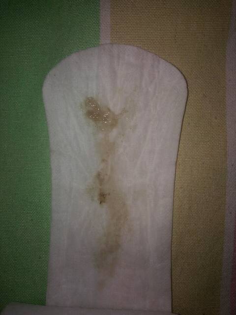 这是什么_孕38周加5天 今天早上肚子疼上厕所