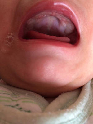 我家宝宝六个多月最近发现上牙床内侧好像长了