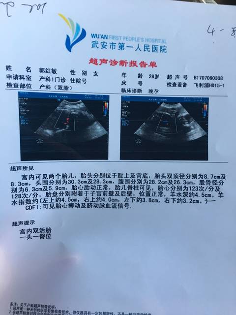 孕35周,一个胎儿发育延缓两周_孕35周,一个胎