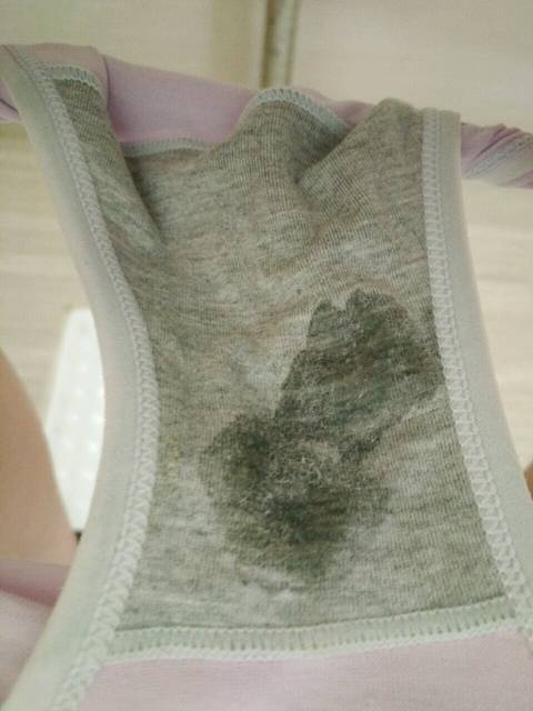 怀孕11+6周,感冒咳嗽去看医生,从医院刚回来内裤就湿了,