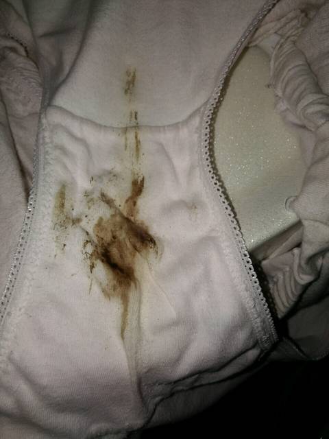 孕早期长时间出褐色分泌物宝妈的安心帖