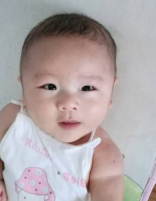 扁头型应该没事3个月7天,也好看吧。