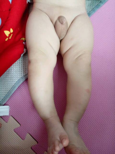 六个月宝宝腿型正常什么样?_宝宝六个月 发现