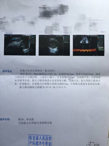 右肾集合系统分离7mm是什么意思