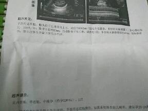 33周胎儿发育情况胎盘附着子宫后壁,成熟度0级