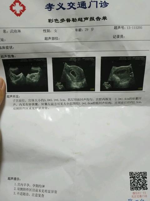 怀孕早期胎儿发育不良的话对以后有没有影响_